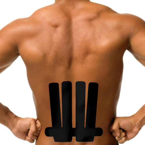 Spinal Manipulation for Low-Back Pain